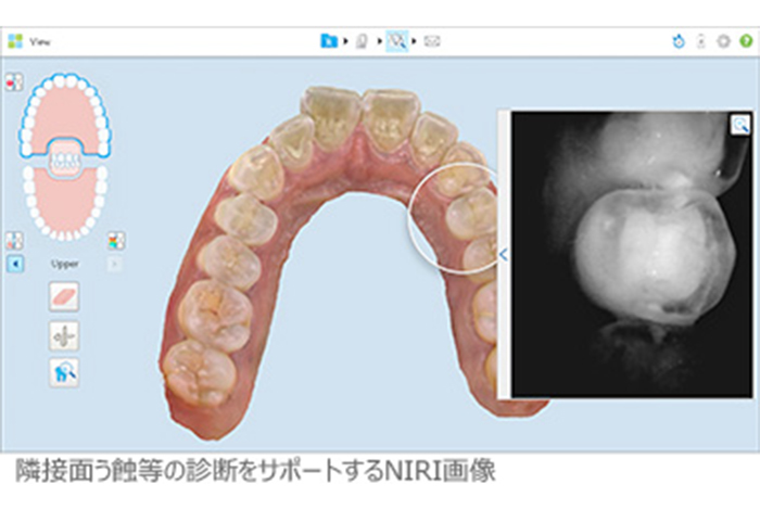 患者さまに直接触れる器具の使い捨ての推進