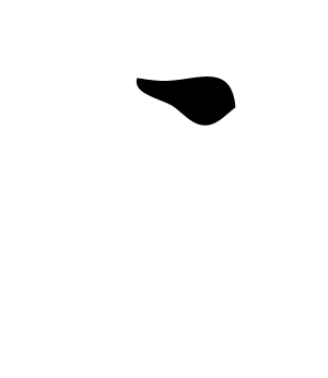 東京虎ノ門グローバルスクエア歯科の痛みの少ない虫歯治療