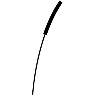 東京虎ノ門グローバルスクエア歯科のマイクロスコープを使用した精密な根管治療