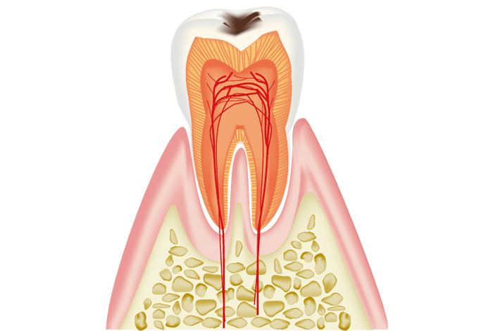 C1